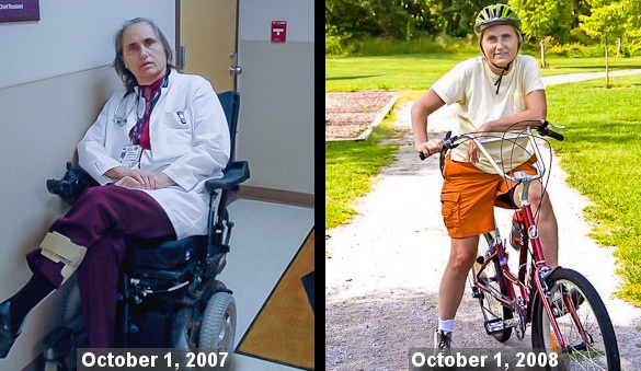 Wahls multiple sclerosis improved with Paleo diet